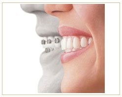 Slider image (8) PrimaDent Dental Center